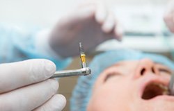 Dentist in Bartlesville performing dental implant surgery