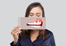 A 3D illustration of laser periodontal treatment