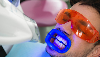 Man receiving in-office teeth whitening 
