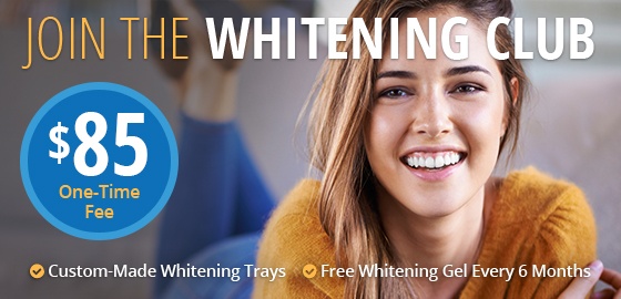 Join the Whitening Club $85 One-Time Fee