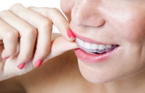 Did you know you can straighten your teeth without ruining your polished look with Invisalign in Bartlesville?