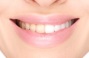 Benefit from at-home or in-office teeth whitening in Bartlesville.